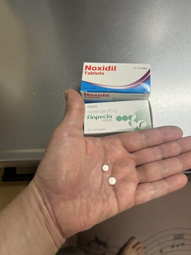 フィンペシア1mgキノリンイエローフリー(100錠1箱)＋ノキシジル5mg(100錠1箱) レビュー投稿画像 サムネイル